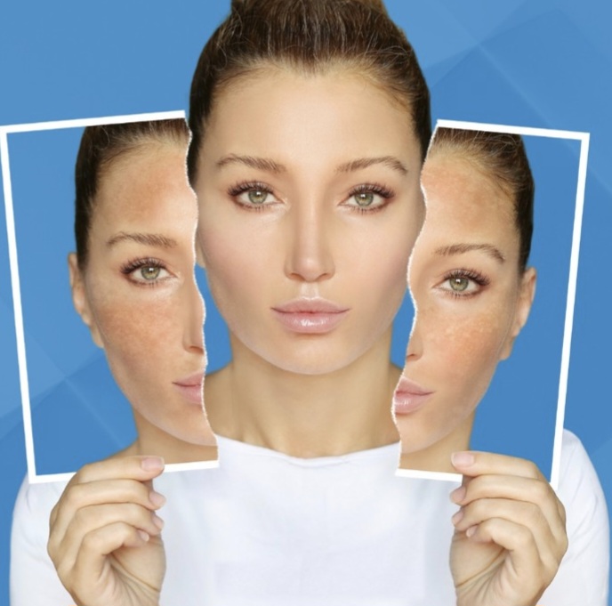 رابطه ضد آفتاب رنگی با لک صورت