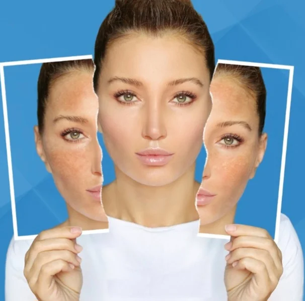 رابطه ضد آفتاب رنگی با لک صورت